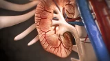 Adrenal Vein Sampling