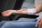 Hemodialysis Fistula/Graft Angiography/Maintenance