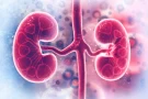 Non-Surgical Hemodialysis Fistula Creation (EndoAVF)