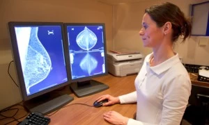 Breast Radiologists