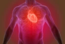 Thoracic Outlet Syndrome Evaluation and Management