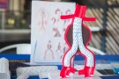 Visceral Aneurysm Evaluation and Management