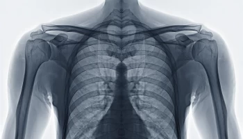 X-Ray Procedures
